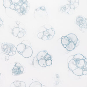 Untitled I-V by Tara Donovan, a 2004 set of prints at Krakow Witkin Gallery, Boston